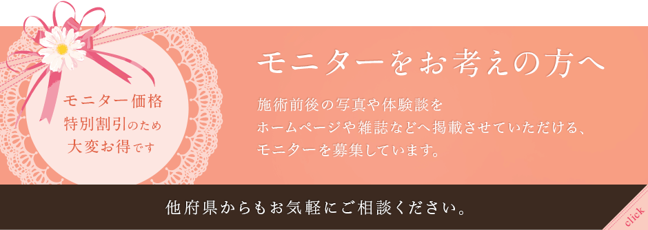 モニターをお考えの方へ